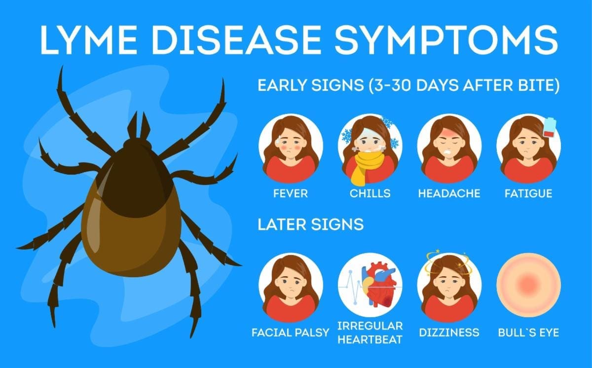 Lyme disease symptoms. early signs three to thirty days after bite. fever, chills, headache, fatigue. Later signs. facial palsy, irregular heartbeat, dizziness, bull's eye on skin.